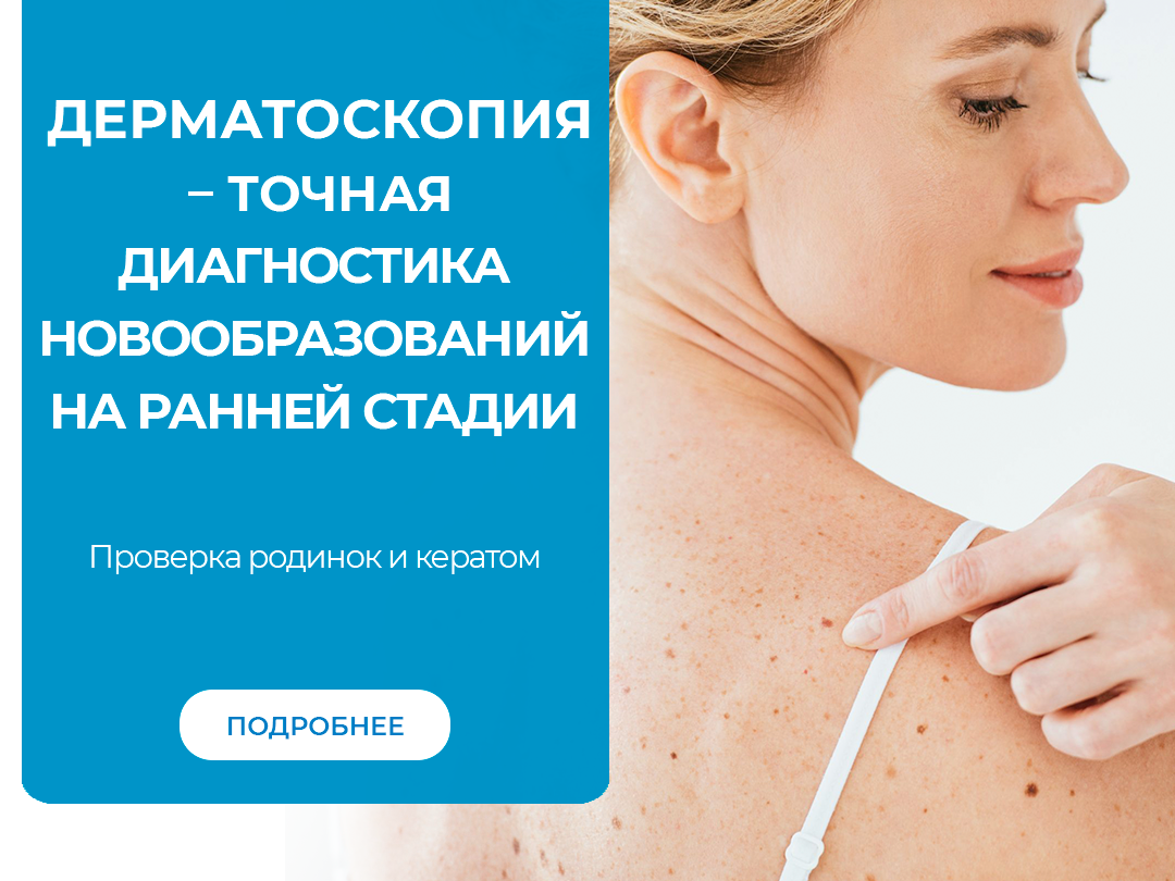 Дерматоскопия – точная диагностика новообразований на ранней стадии