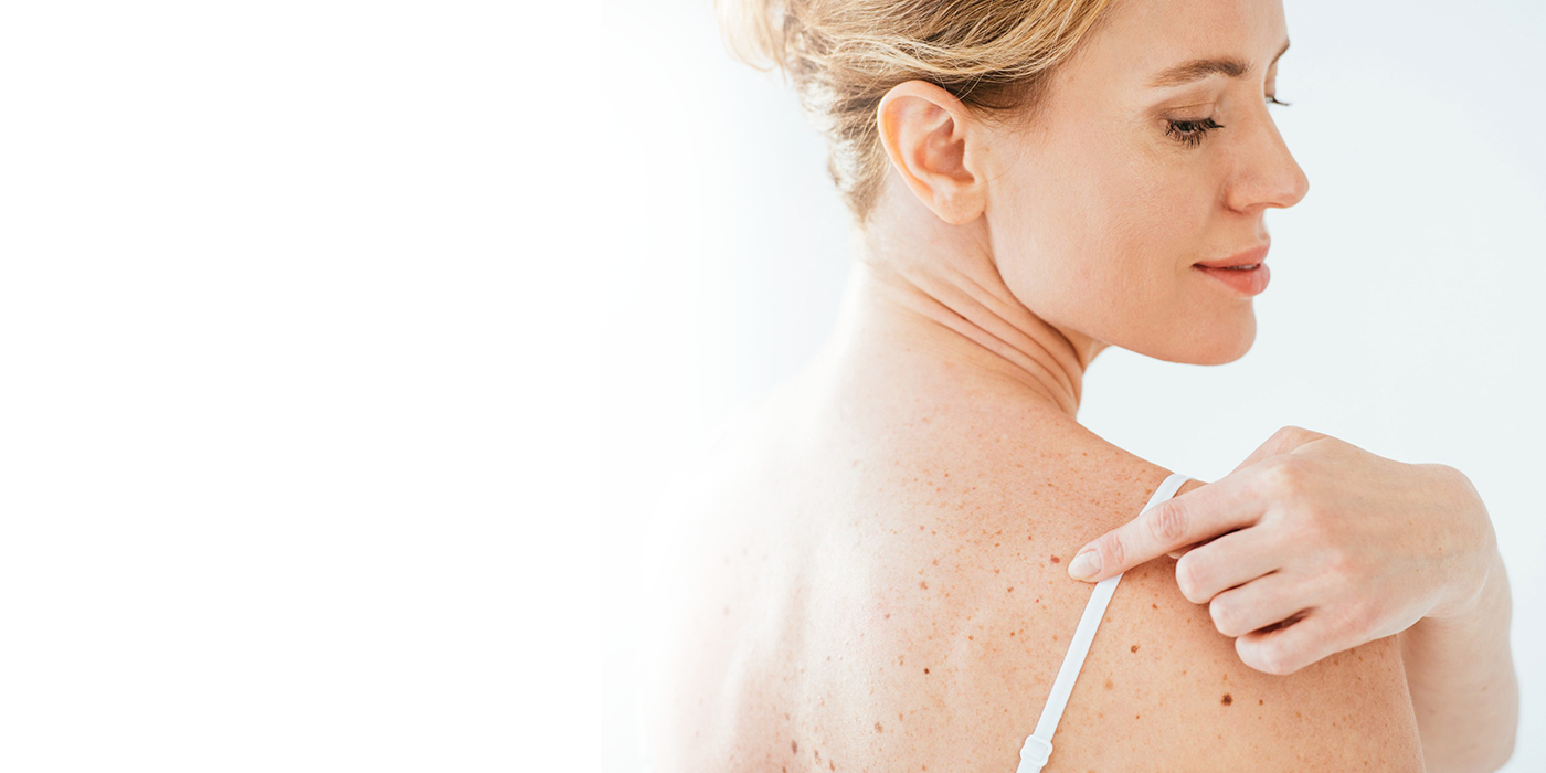 Дерматоскопия – точная диагностика новообразований на ранней стадии